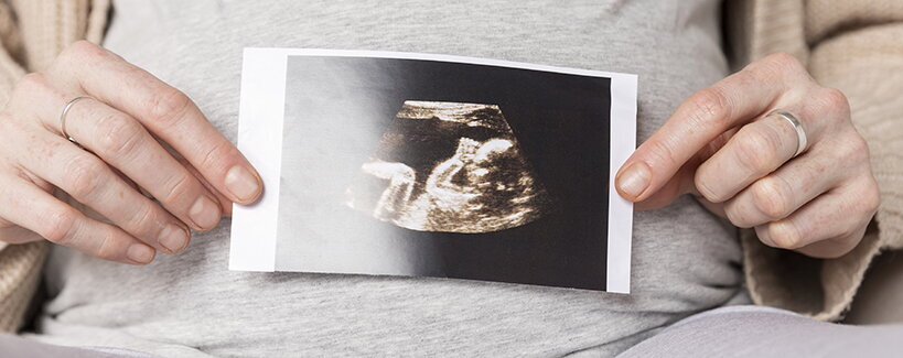 Otočení miminka v bříšku